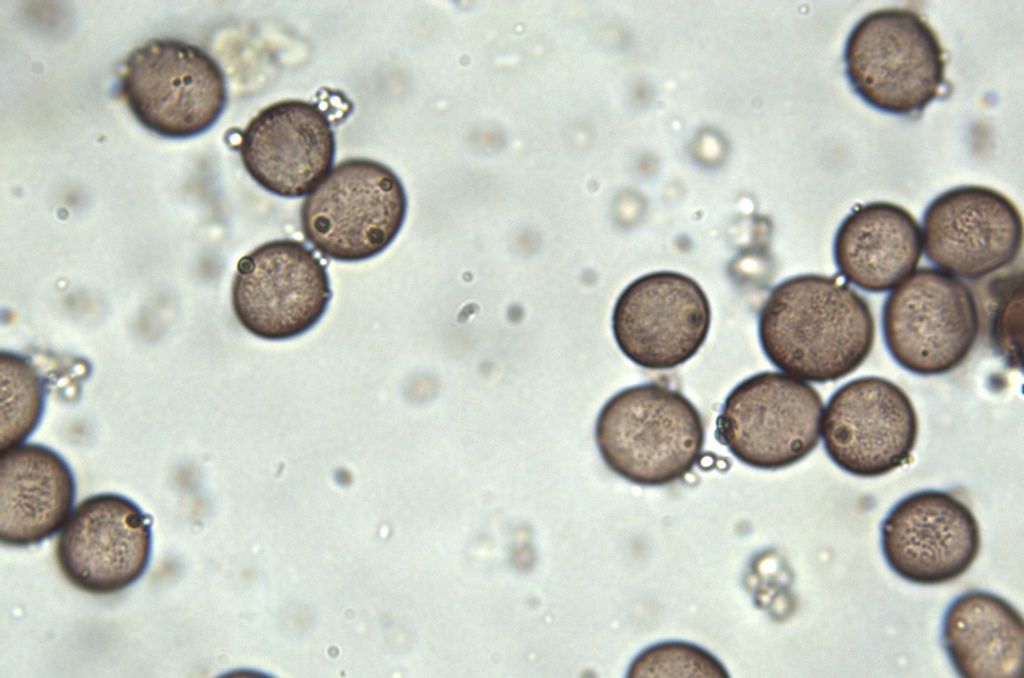 Physarum cf pusillum